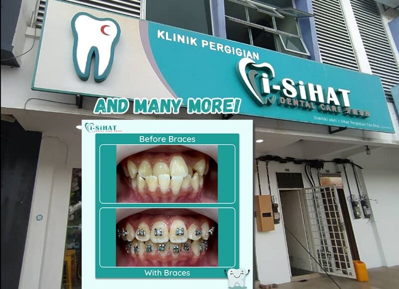 I-Sihat Dental Care (Pasir Gudang)