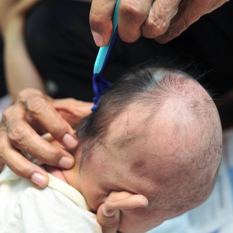 cukur jambul bagi aqiqah anak lelaki