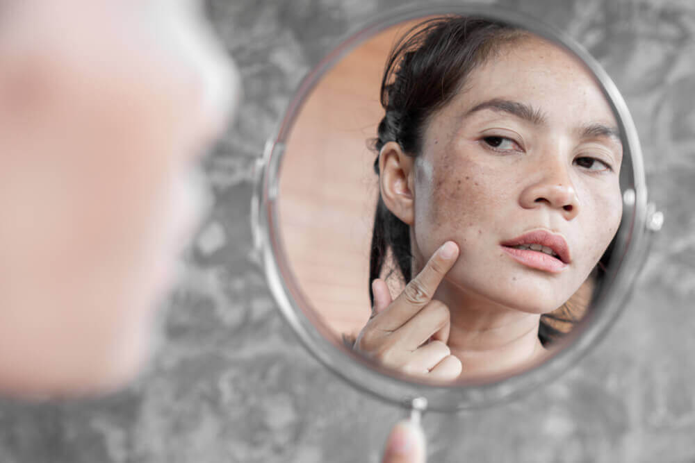 wanita melihat punca kulit kusam dan hyperpigmentation di cermin