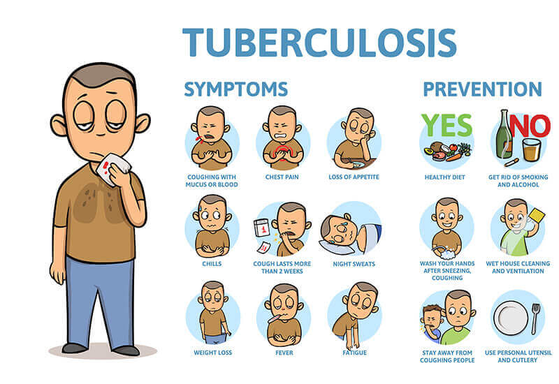 simptom tuberkulosis (TB)