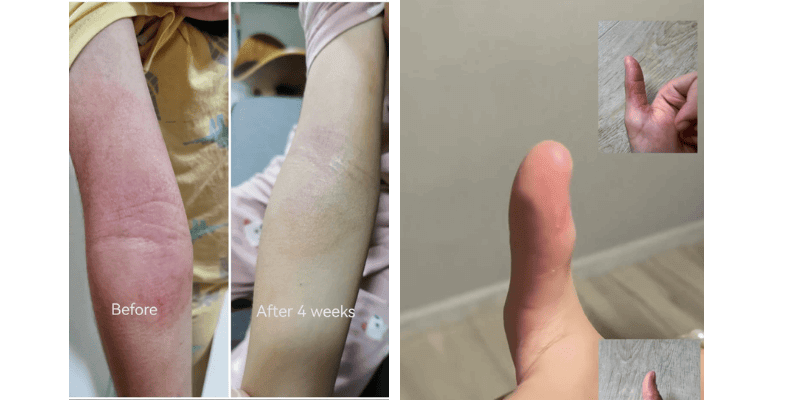 Little Étoile before and after